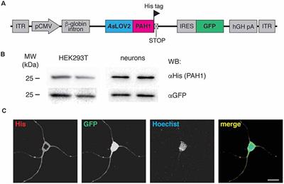 Mild Inactivation of RE-1 Silencing Transcription Factor (REST) Reduces Susceptibility to Kainic Acid-Induced Seizures